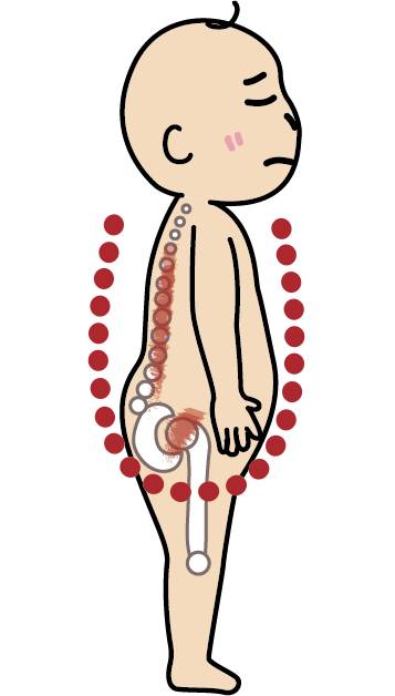 不舒適的脊椎 ＆ 髖關節位置1